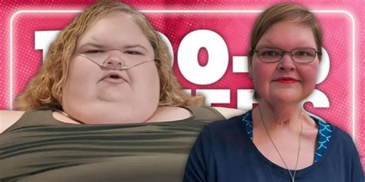 1000Lb Sisters Why Tammy's Skin Removal Surgery Is Exciting