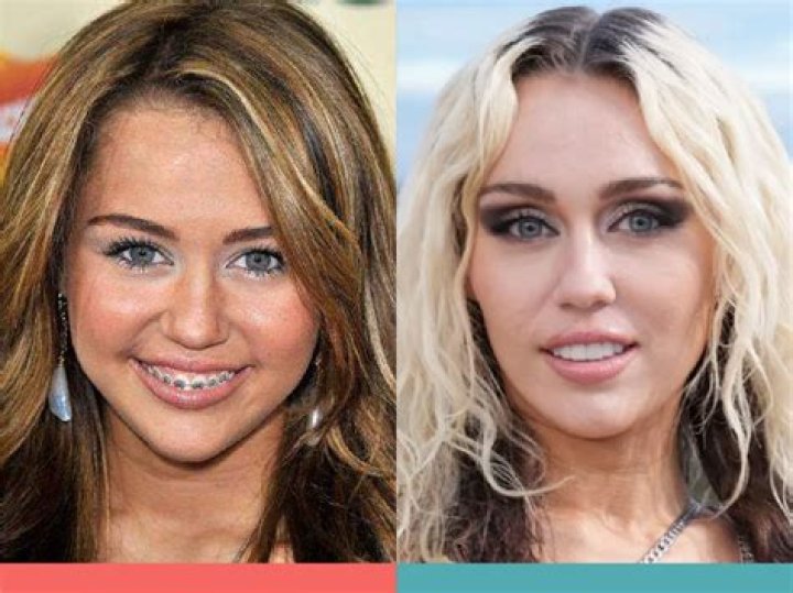 6 Celebrities With Braces Before and After &mdash; Wonderful Transformations