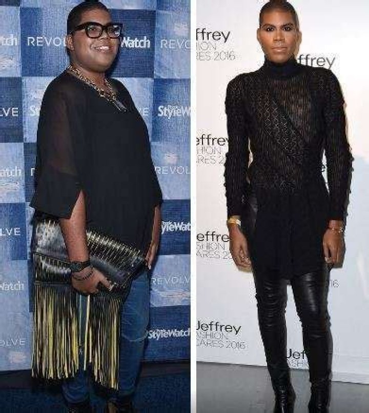 BEFORE & AFTER E.J. Johnson's lost 50 lbs. and counting since gastric