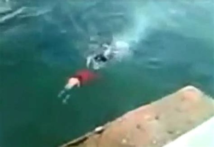 Face Split Diving Accident Boy face split while Diving