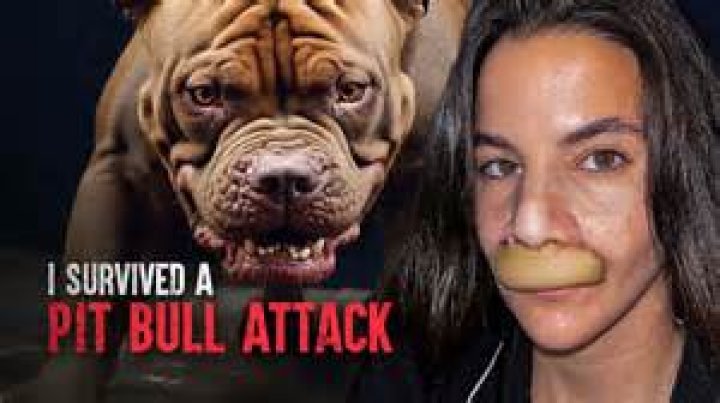 Horror pit bull attack leaves woman with multiple amputated limbs