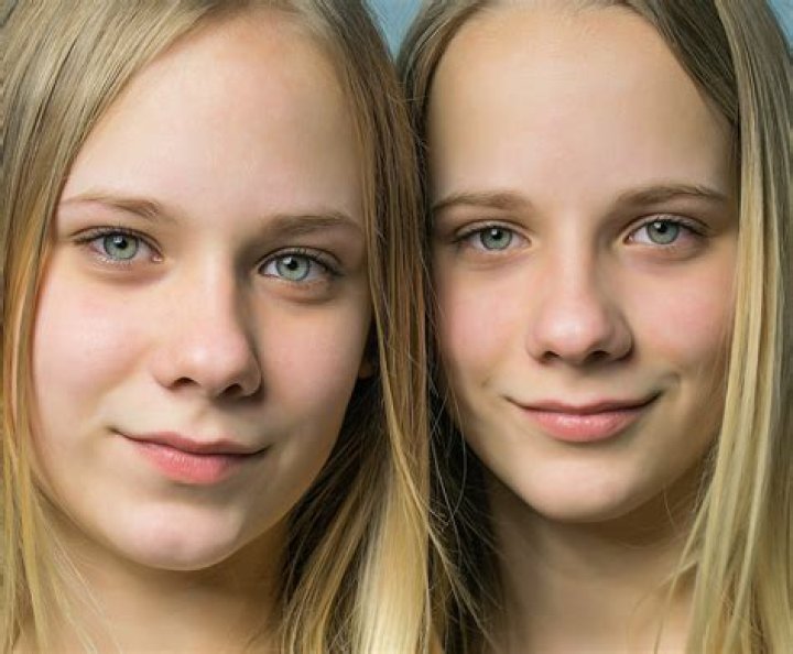 Identical twins no longer identical early in development