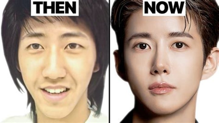 Korean Actors Before And After Plastic Surgery Korean Actors/actresses