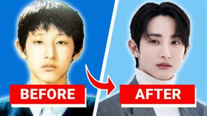 Korean Actors Plastic Surgery Before And After