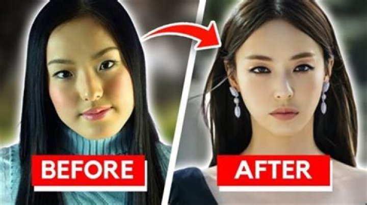 Korean Actors Surgery Before And After