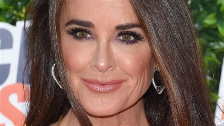 Kyle Richards Had A Stunning Plastic Surgery Transformation