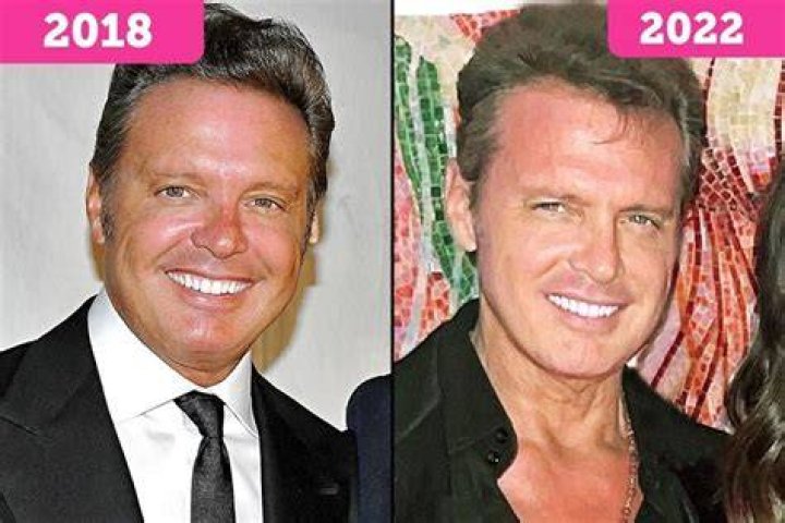 Luis Miguel Weight Loss Singer Uses A "Controversial" Technique To Lose Weight!