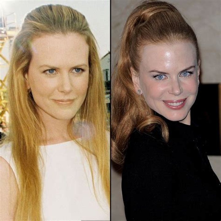 Nicole Kidman's Divorce Celebration Picture Remains Absolutely Iconic