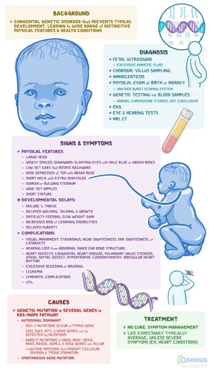 Noonan Syndrome AAFP