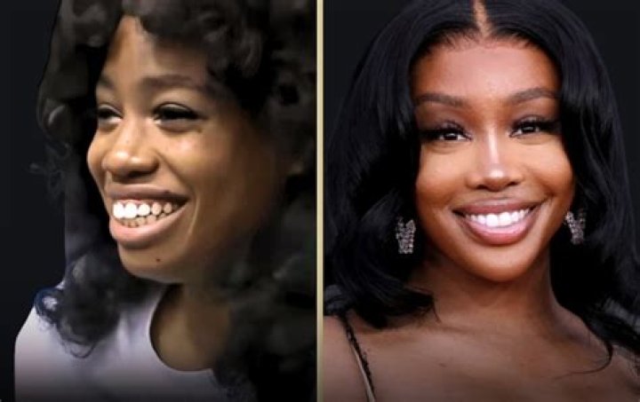 SOS SZA Confirms Plastic Surgery Rumors On New Album, Sending Fans