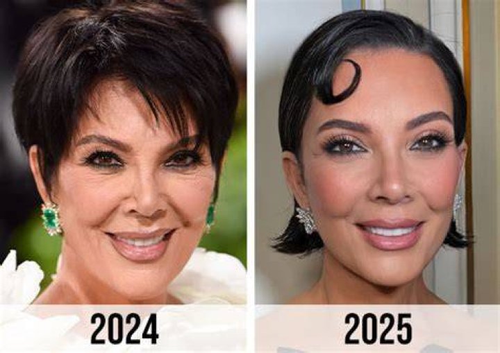 The Unveiling Transformation Kris Jenner's Sister's Facelift Cosmeticium