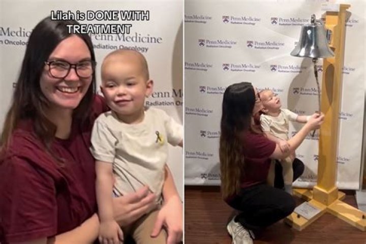 Two year old with rare form of dwarfism