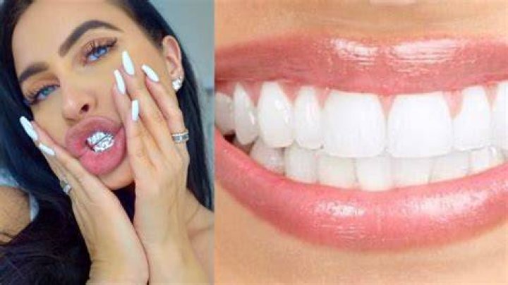 Who has the whitest teeth in the world? Daily Media NG